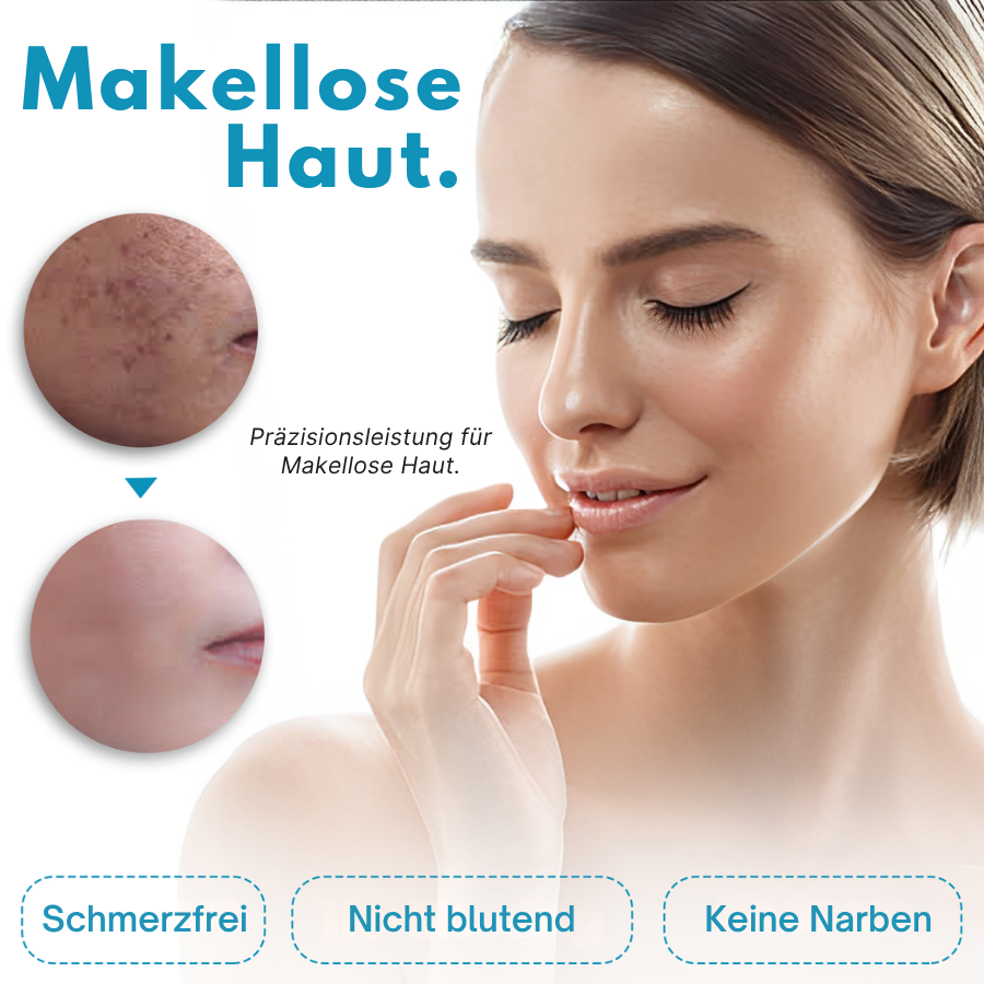 Bikenda® Heimgebrauch CO2 Laser-Schuss Ausradieren Pro