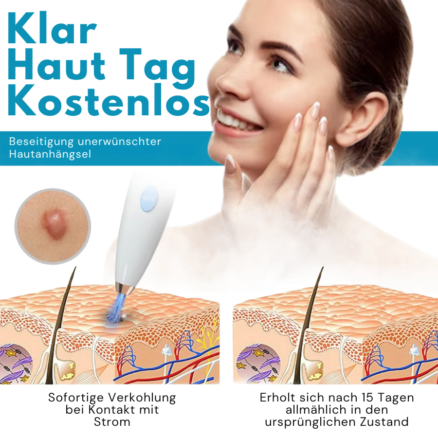 Bikenda® Heimgebrauch CO2 Laser-Schuss Ausradieren Pro