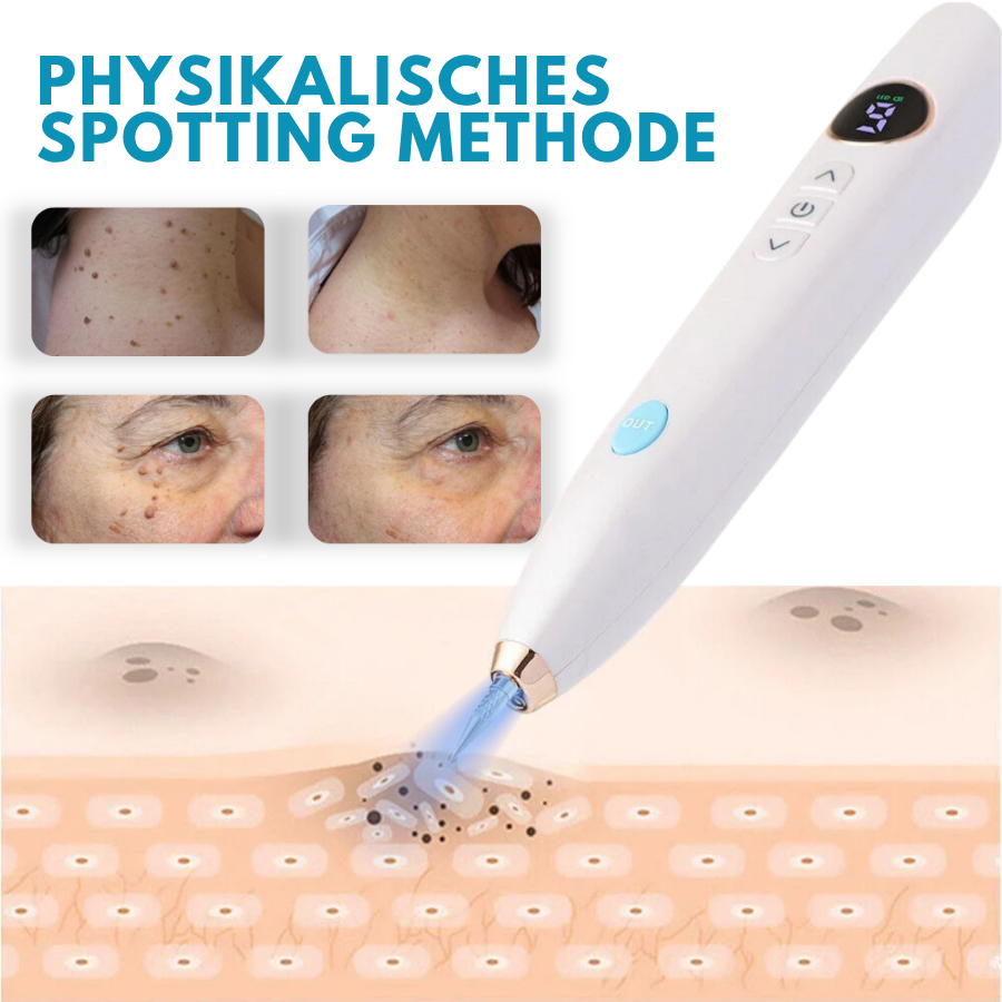 Bikenda® Heimgebrauch CO2 Laser-Schuss Ausradieren Pro