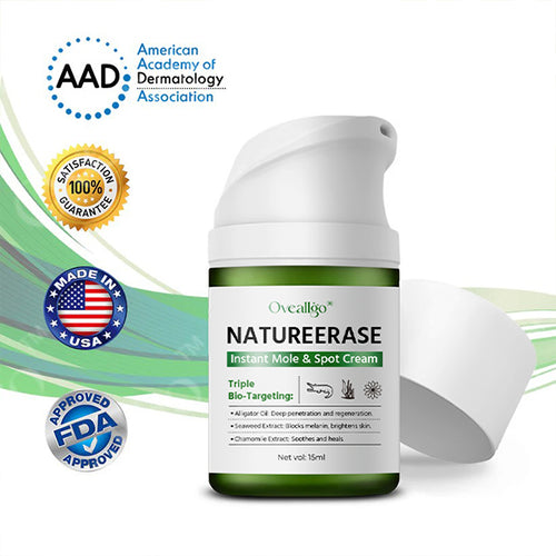 ✅ Offizieller Laden: Oveallgo® NatureErase Sofort Maulwurf & Flecken-Creme