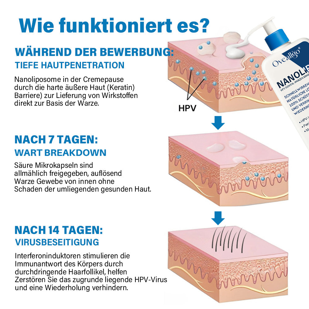 Oveallgo® NanoLipo HPV Genital warzen-Eraser creme Plus