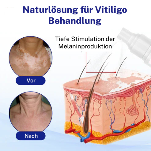 Oveallgo® Evenora Kräuterspray Pro