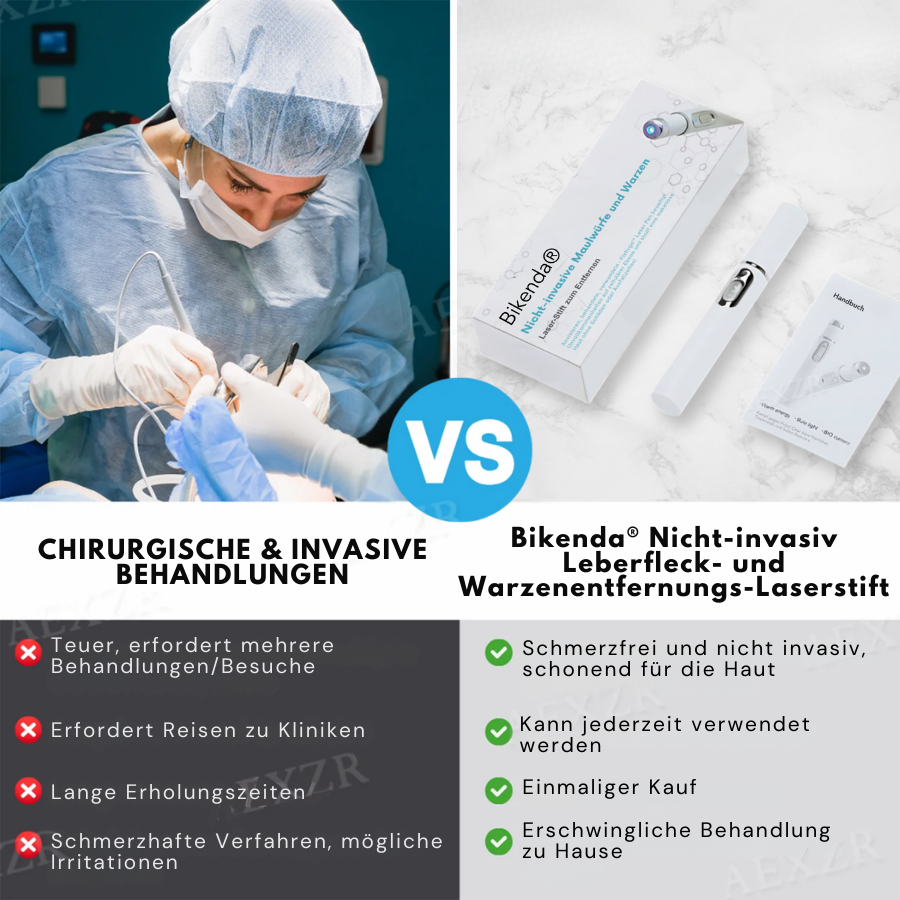 Bikenda® Nicht-invasiv Leberfleck- und Warzenentfernungs-Laserstift