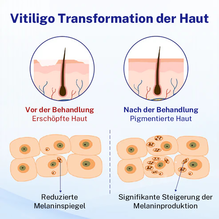 Oveallgo® Evenora Kräuterspray Pro
