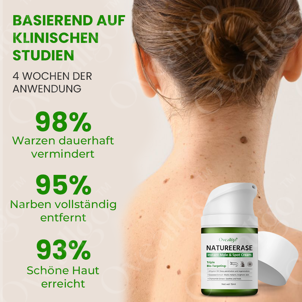✅ Offizieller Laden: Oveallgo® NatureErase Sofort Maulwurf & Flecken-Creme