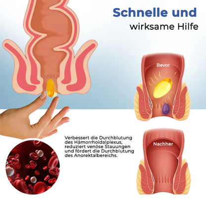 Oveallgo® Natürliche Hämorrhoiden-Kapseln