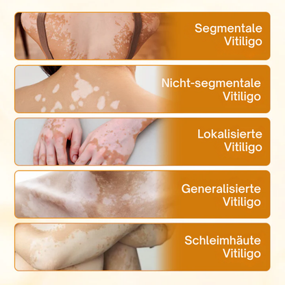 Oveallgo® VitiClear Plus Bienengift Creme