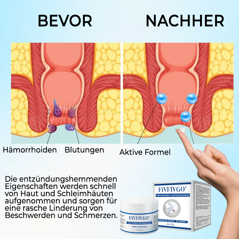 Fivfivgo® Hämorrhoiden- und Fissurencreme