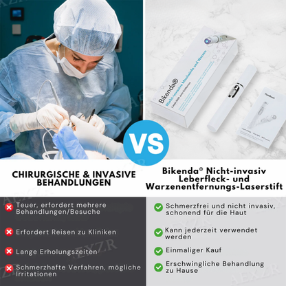 Bikenda® Nicht-invasiv Leberfleck- und Warzenentfernungs-Laserstift