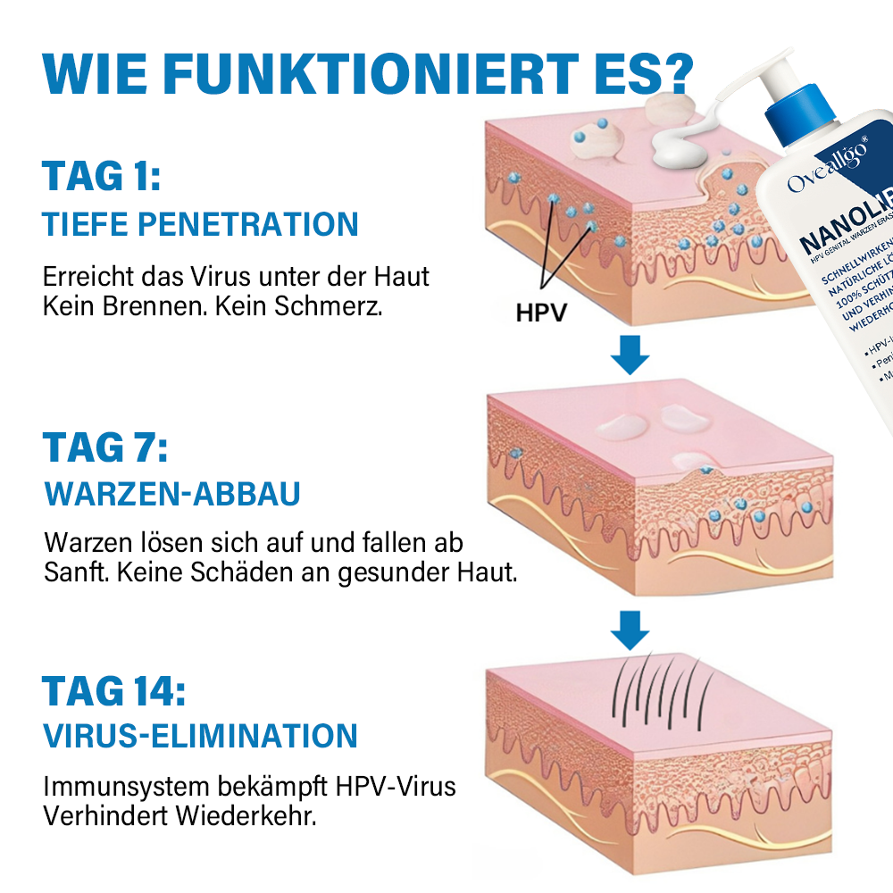 Oveallgo® NanoLipo HPV Genital warzen-Eraser creme