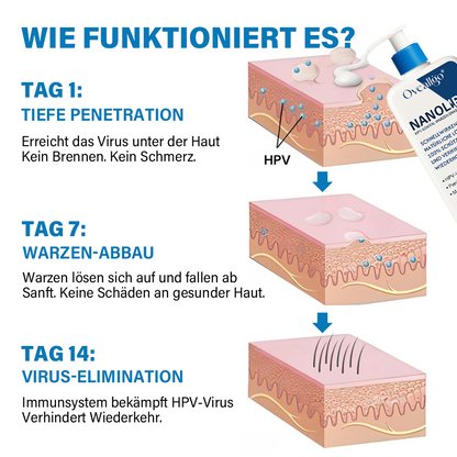 Oveallgo® NanoLipo HPV Genital warzen-Eraser creme